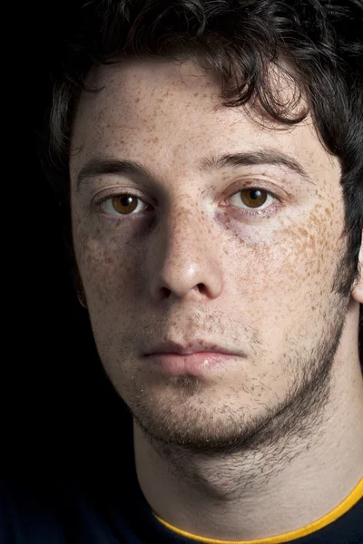 Serious Man with Freckles — Stock Photo, Image
