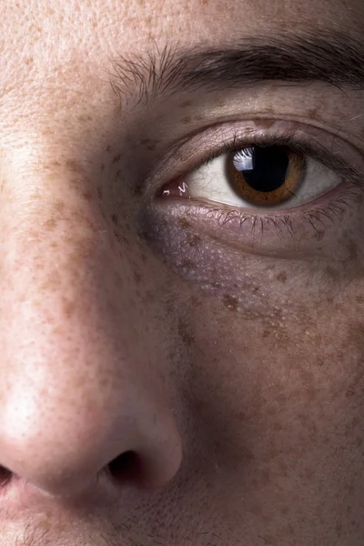Eye with Freckles — Stock Photo, Image