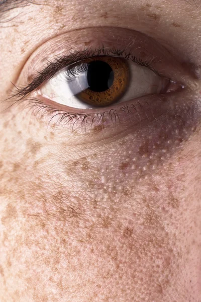 Eye with Freckles — Stock Photo, Image