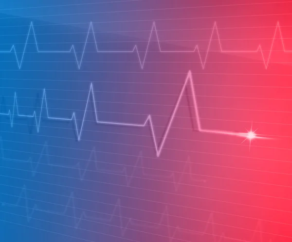 Ekg-Linie — Stockfoto