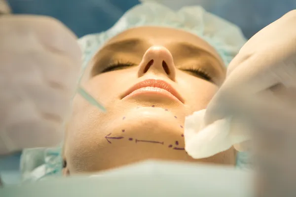 Patients chin with marks before operation — Stock Photo, Image