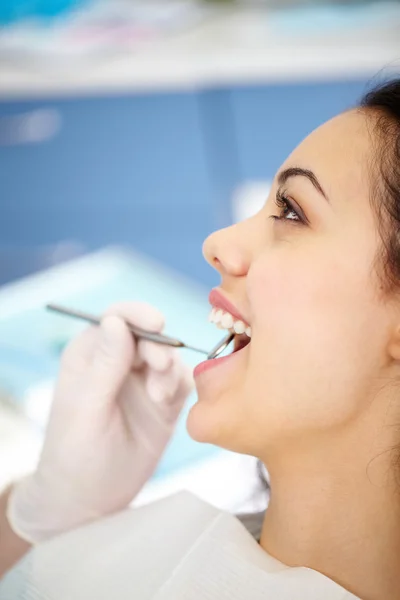 Kontrollera upp tänder — Stockfoto